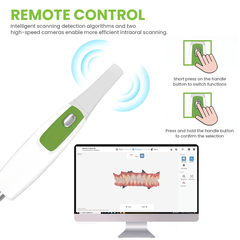 Escáner intraoral 3D para perros y gatos con imágenes color reales - imagen 2