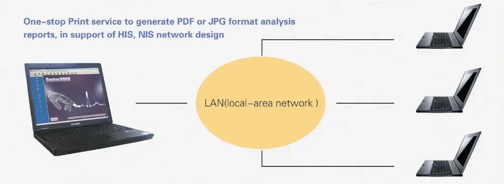 CONTEC8000G/GW ECG EKG sistema de estación de trabajo portátil multifunción 12 cables máquina de ECG de descanso impresión rápida + software - imagen 4