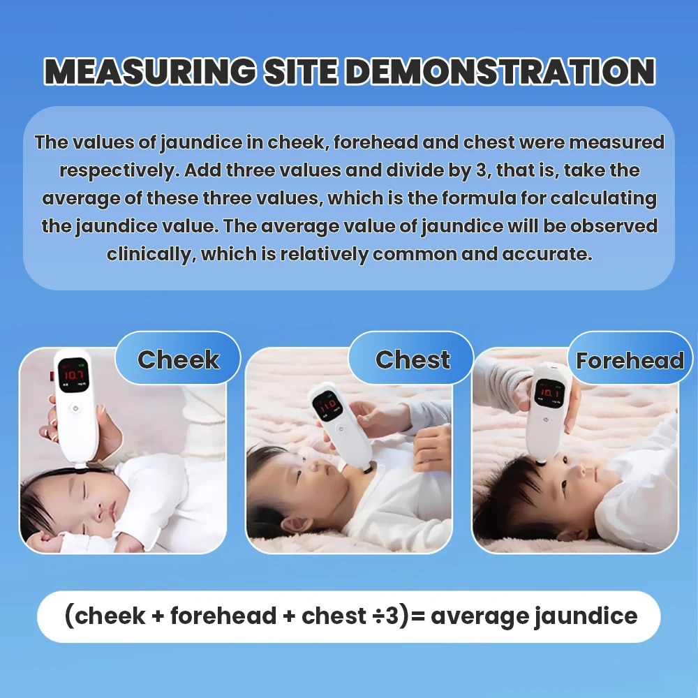 Detector de ictericia para bebés L11C, medidor de ictericia neonatal, instrumento portátil para examen dinámico clínico - imagen 5