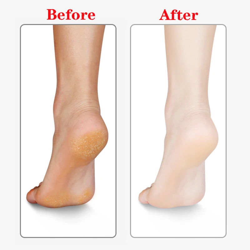 Lima para pies, eliminador de callos de piel muerta dura, herramientas de Pedicura de nanovidrio, depurador de pies, molienda profesional de pies, cuidado de la piel, Pedicura - imagen 4