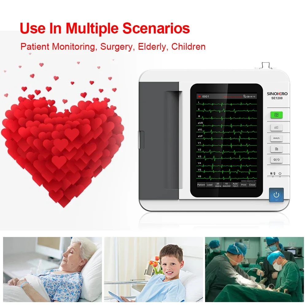 SE1200 Máquina de ECG electrocardiógrafo de 12 canales y 12 derivaciones con pantalla táctil de 10,1 pulgadas con impresión térmica - imagen 5