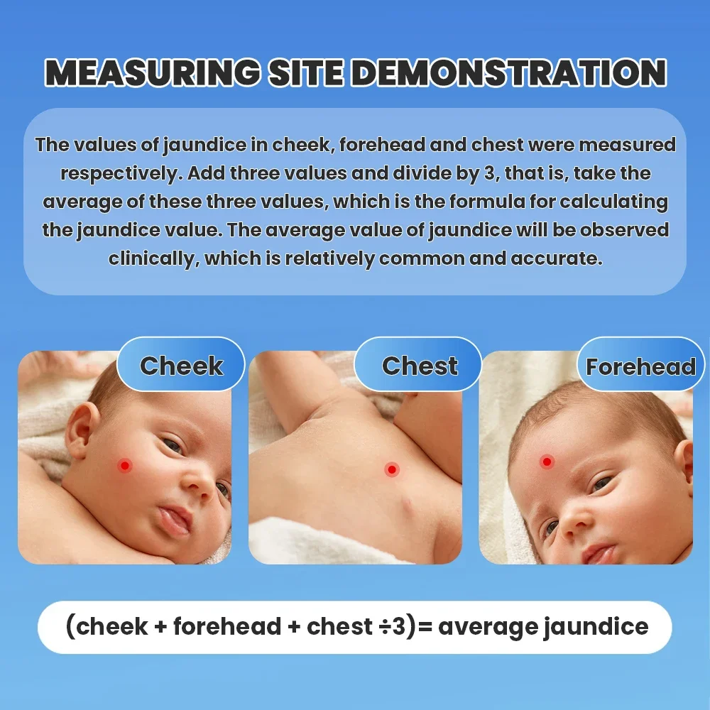 Medidor de ictericia neonatal Detector de ictericia para bebés NICU o pesebre de recién nacidos Bilirubinómetro transcutáneo Medidor de bilirrubina - imagen 4