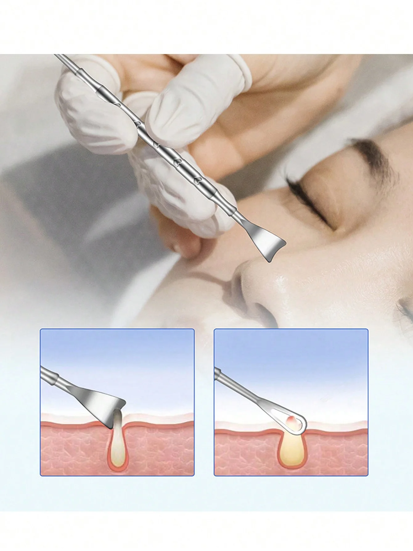 Herramienta acero inoxidable para espinillas y puntos negros - imagen 4