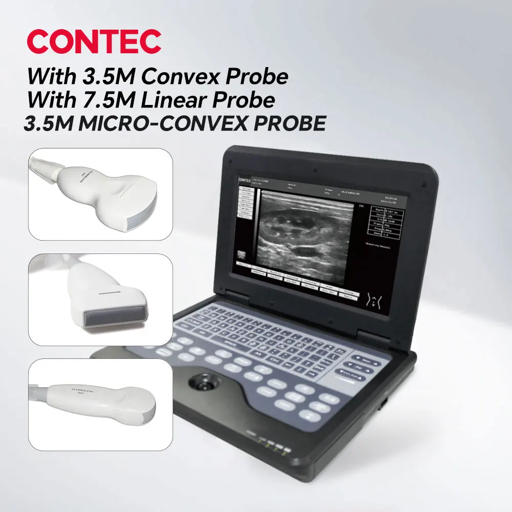Convex Linear Cardia