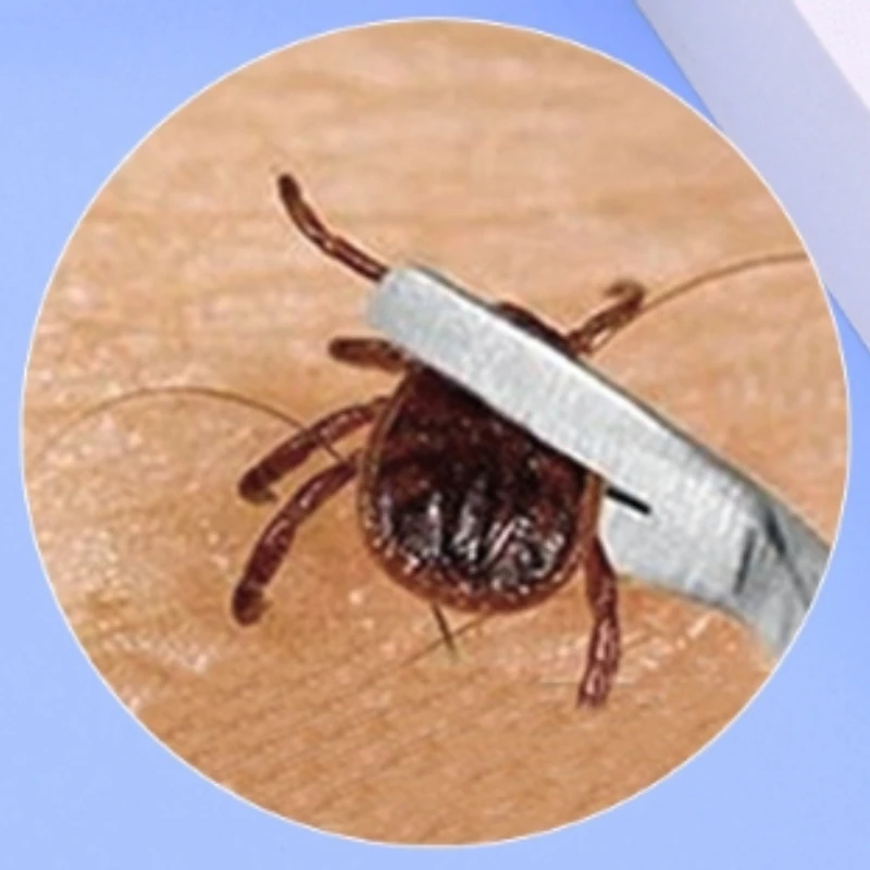 Herramienta para quitar garrapatas de acero inoxidable 2 en 1, pinzas profesionales para quitar pulgas y garrapatas con gancho de aseo para mascotas y humanos - imagen 3