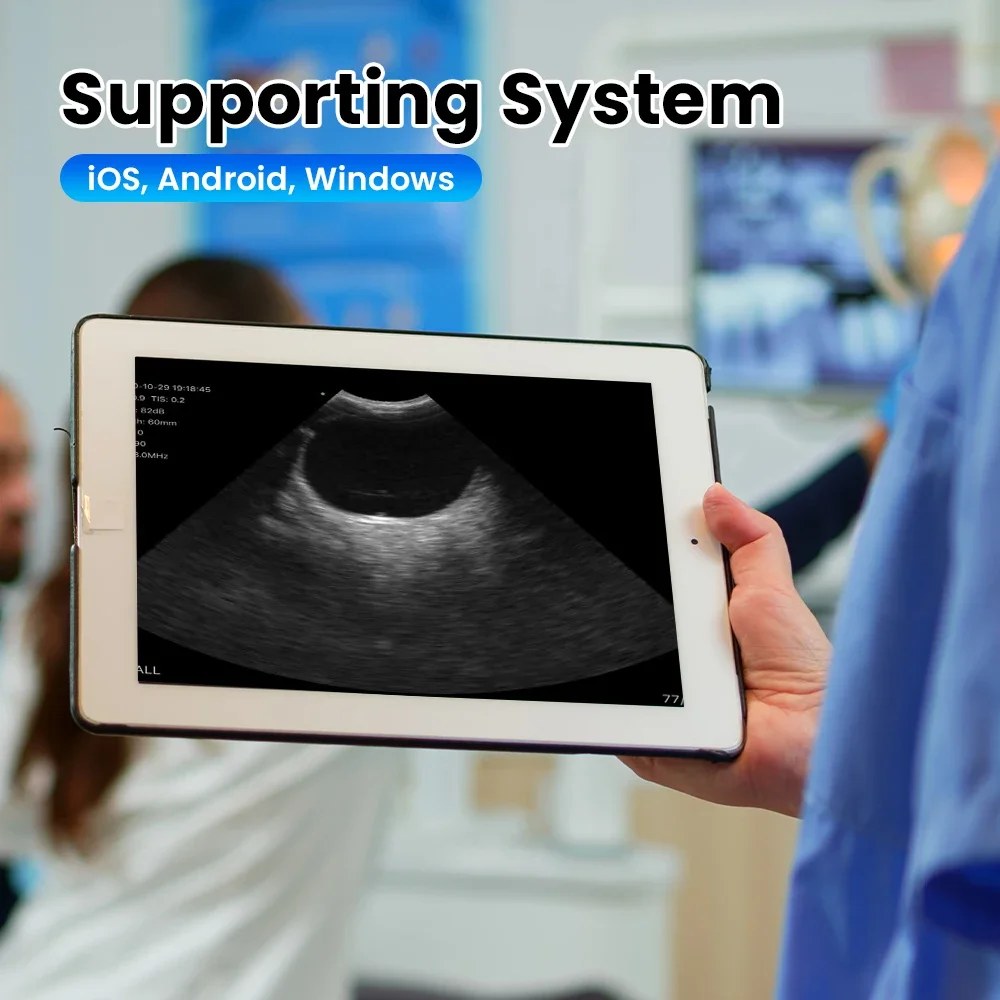 Sonda de ultrasonido inalámbrica para ojos, Doppler ultrasónico de color, uso para oftalmología, neonatología, mascotas pequeñas - imagen 4