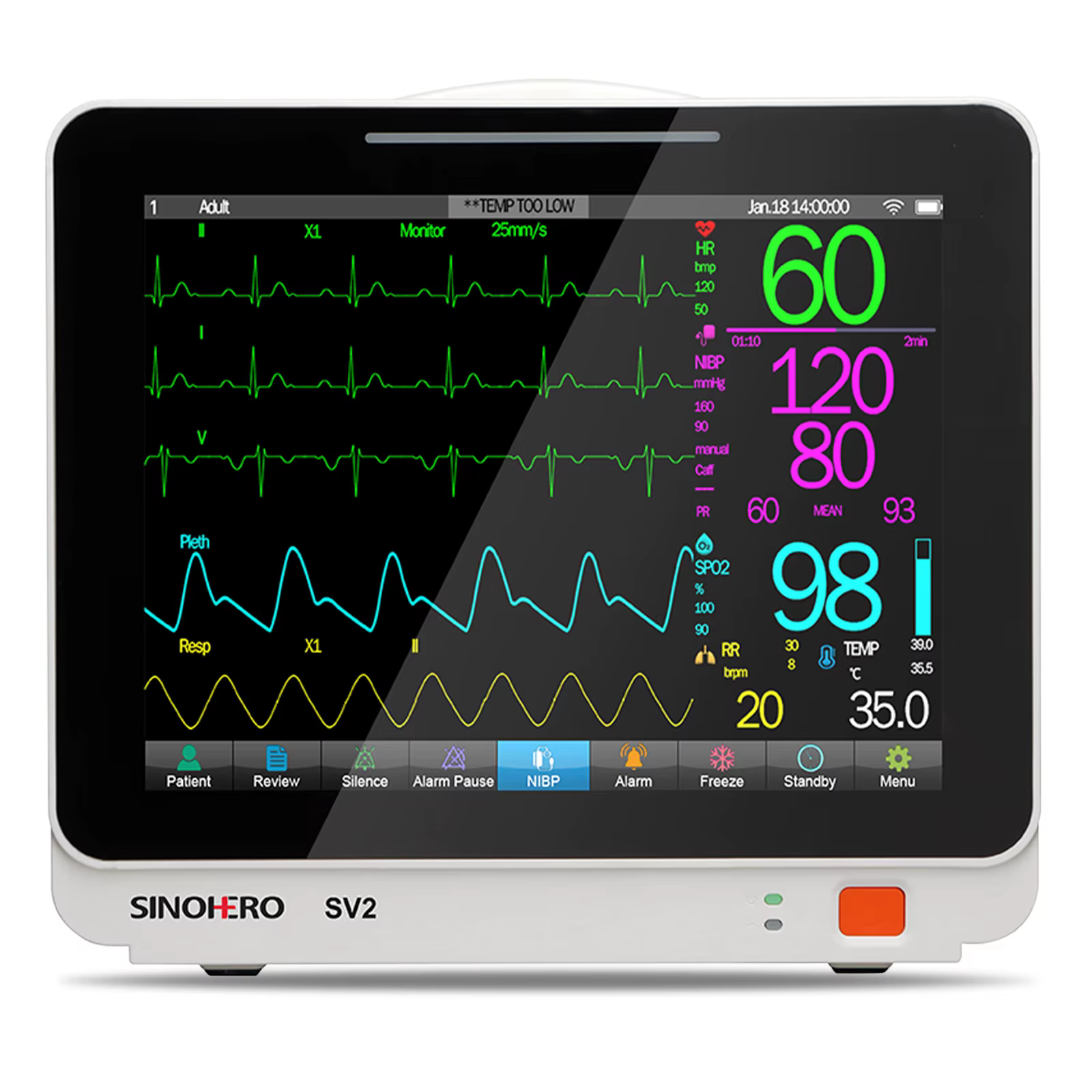 Monitor veterinario multiparamétrico Sinohero SV2 y su pantalla