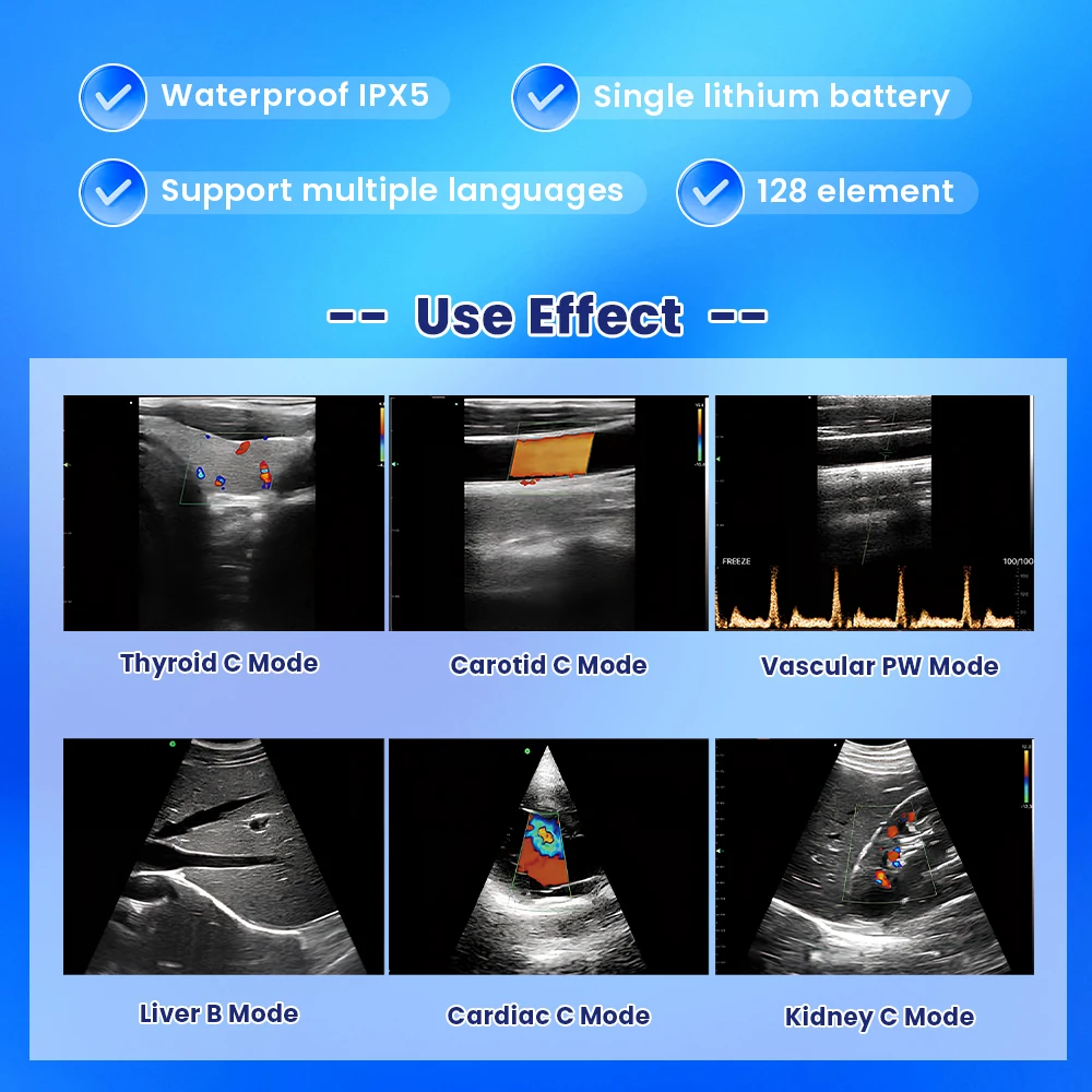 Sonda de ultrasonido para ecografía veterinaria en gatos y perros - imagen 2