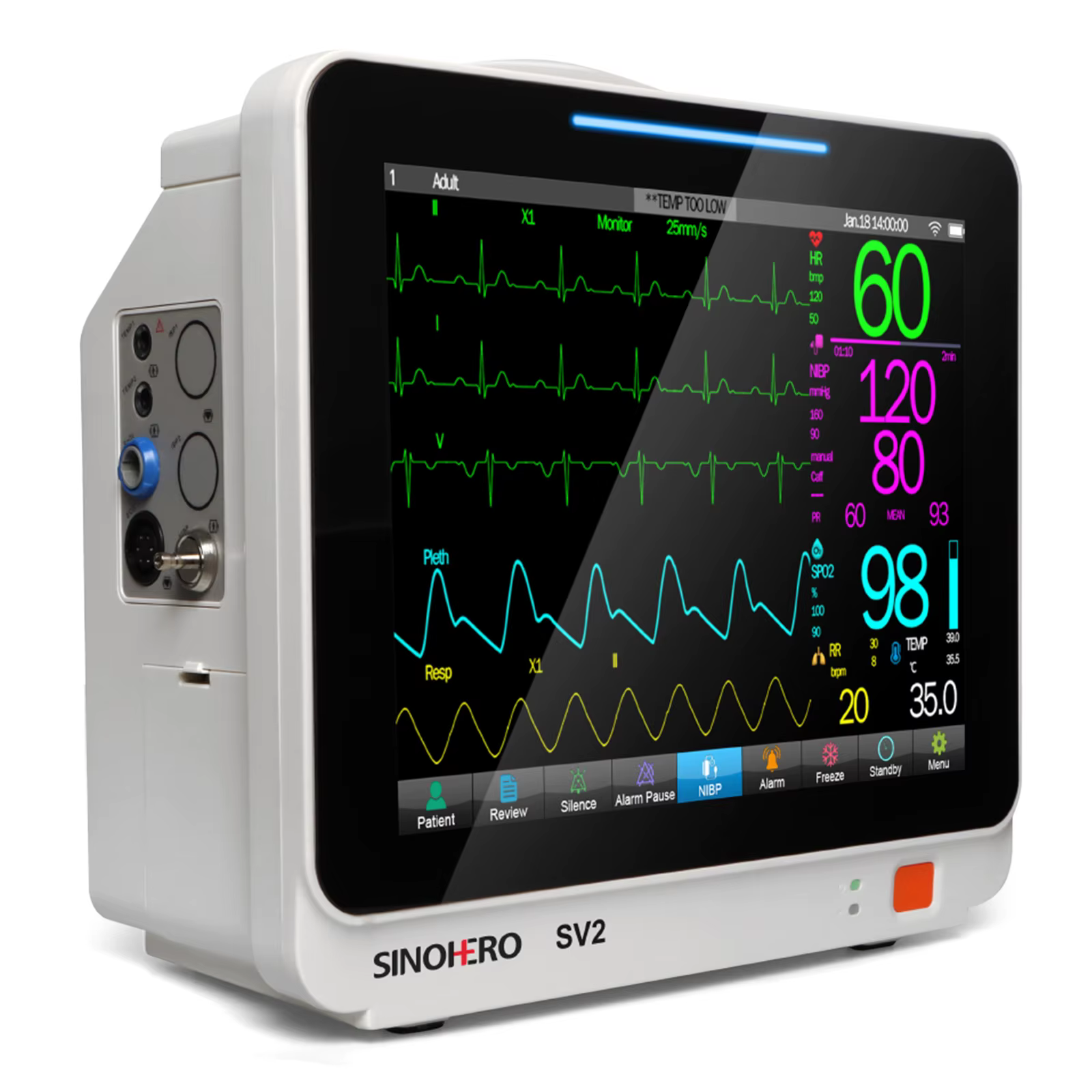 Monitor SV2 con conectividad Wi-Fi para clínica veterinaria