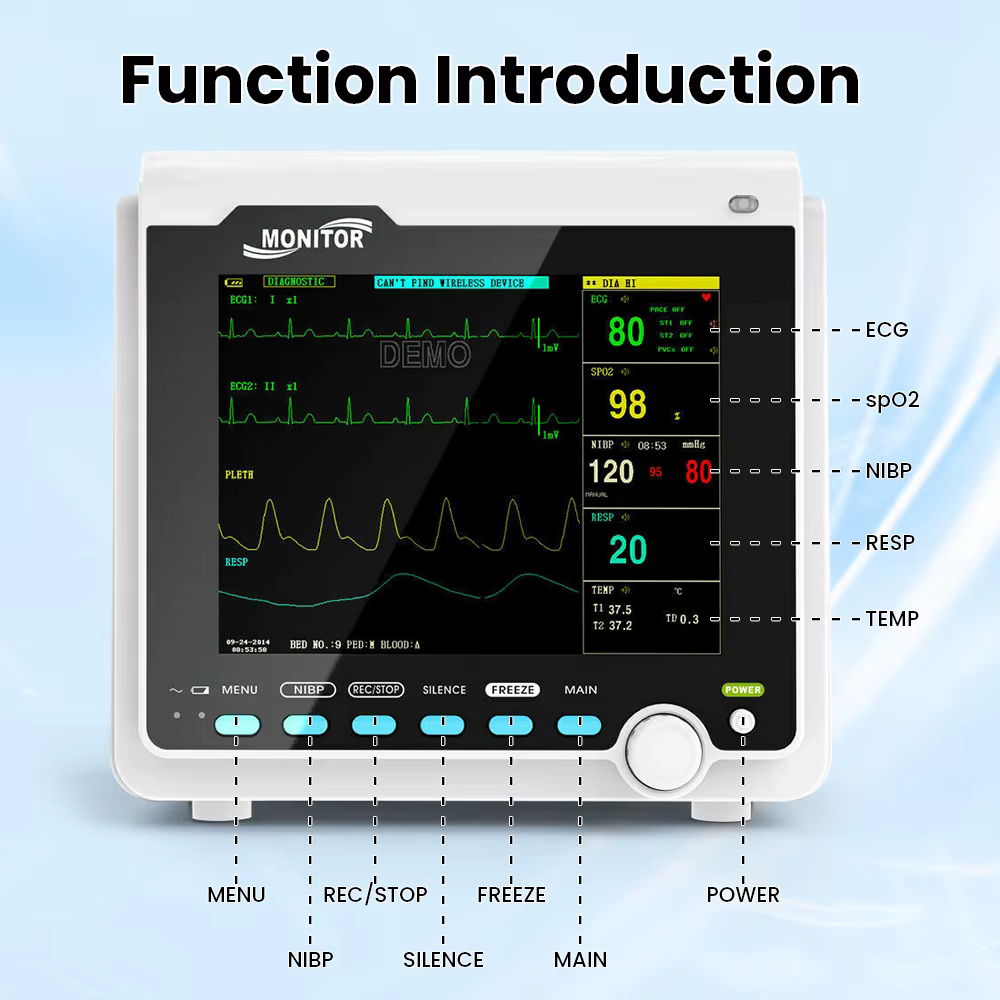 Monitor de Signos Vitales Veterinario Portátil ECG NIBP SPO2 – Máquina Multiparámetros - imagen 3