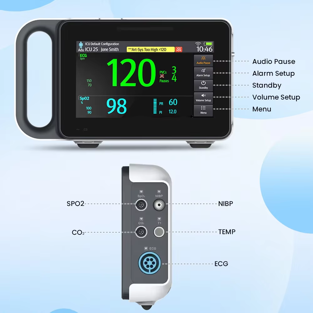 Monitor de signos vitales multiparamétrico portátil para perros y gatos - imagen 4