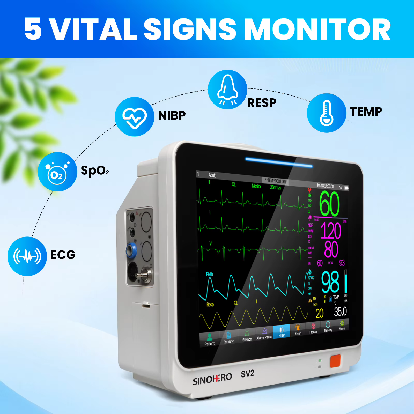 Monitor veterinario SV2 con pantalla táctil de 12.1 pulgadas mostrando signos vitales en clínica